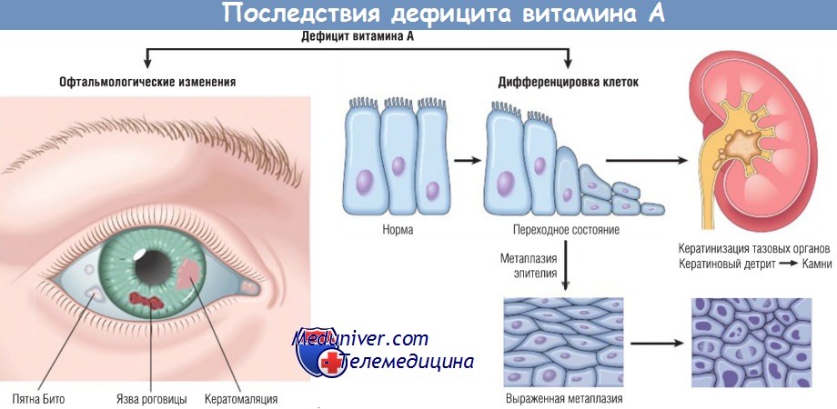 Продукты в которых витамин а. Витамин А: в каких продуктах содержится и для чего он нужен человеку